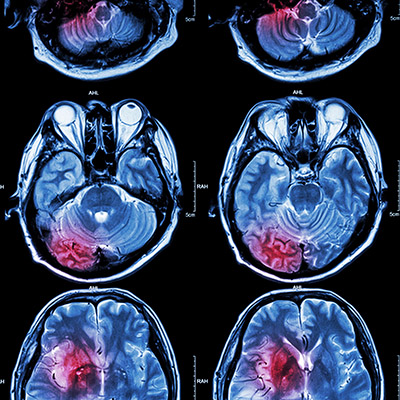 brain scans