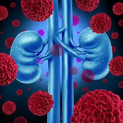 Internal graphic of kidneys