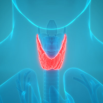 thyroid cancer