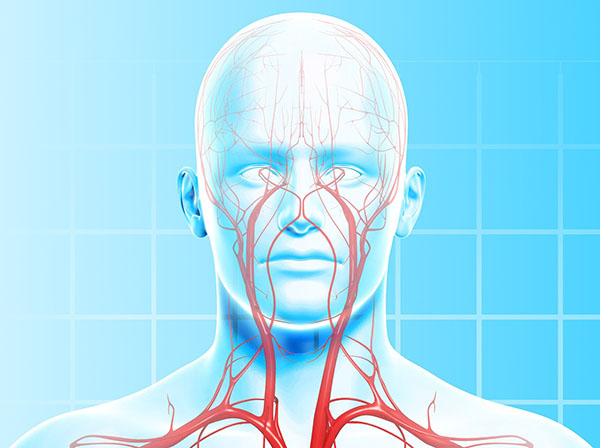 carotid arteries