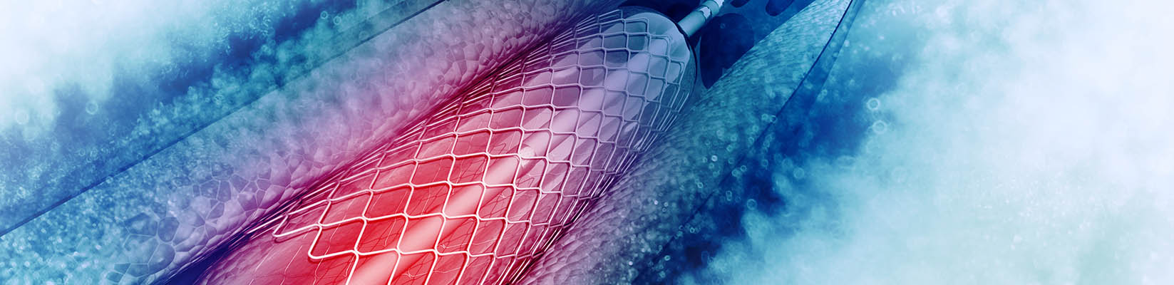 cardiac stent