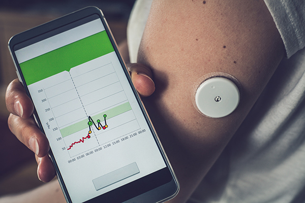 glucose monitor