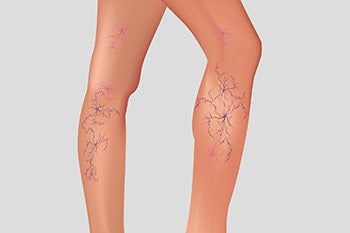 A cropped photo of a pair of legs