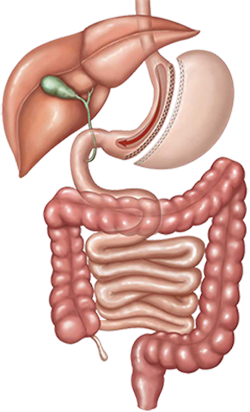 sleeve gastrectomy